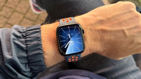 apple watch series 10 aanbieding